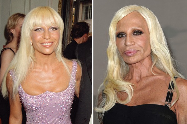 Nada natural! Veja mudanças no rosto de Donatella Versace