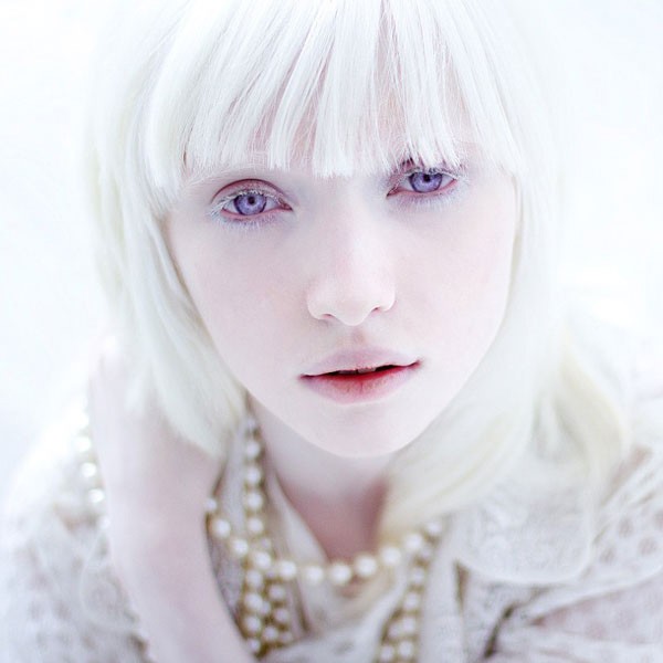 Humano albino