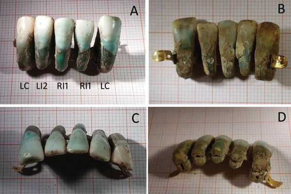 Próteses dentárias muito medievais